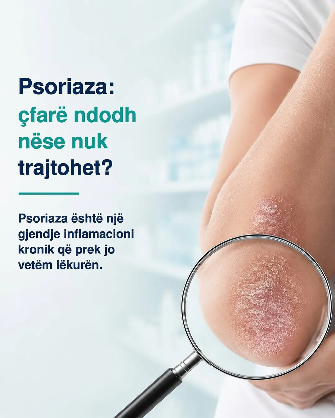 Farmagen post on untreated psoriasis, a magnifying glass held over affected skin beside the explainer headline.